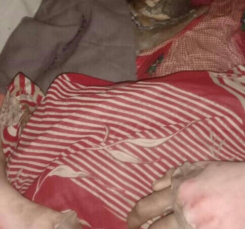 Man sets 15-year-old girl ablaze for rejecting his sexual advances (graphic photos)