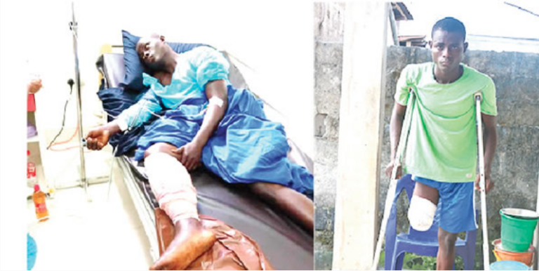 My leg was amputated after I was shot at Lekki Toll Gate — 23-year-old cobbler