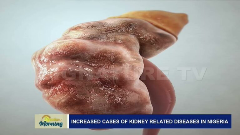 INCREASED CASES OF KIDNEY RELATED  DISEASES IN NIGERIA -WATCH VIDEO